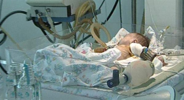 В Славянске мать малыша, которого в больницу в синяках и коматозном состоянии доставил отец, заявила, что ребенок упал с пеленального стола